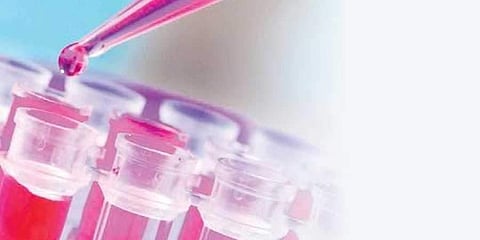 (Image for representation)