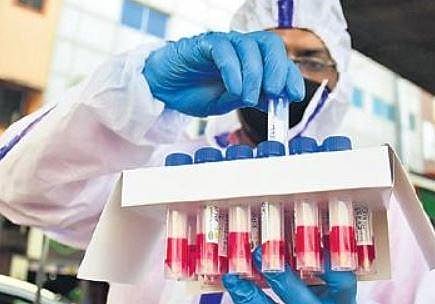 CFTRI working on cheaper, faster test kit