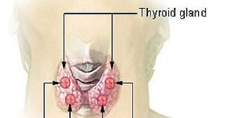 Say goodbye to thyroid issues
