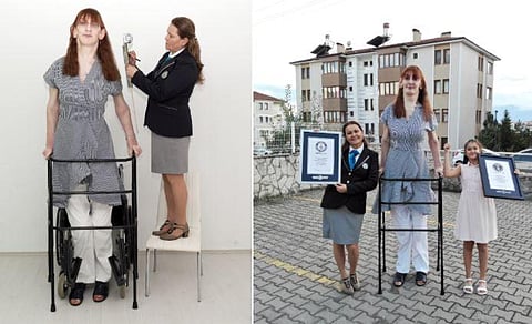 Rumeysa Gelgi (Photo | guinnessworldrecords.com)