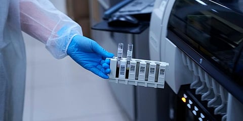 An employee prepares vials for analysis at a LabQuest laboratory, a clinic that does antibody testing and processing, in Moscow, Russia. (Photo | AP)