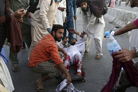 Supporters of Tehreek-e-Labiak Pakistan, a banned radical Islamist party, help their colleague injured in a clash with police during their protest march toward Islamabad (Photo | AP)
