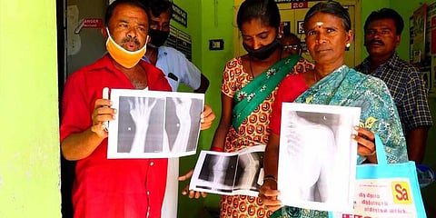 This government hospital in Tamil Nadu prints X-rays on paper!