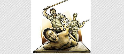 Representational image of custodial torture.