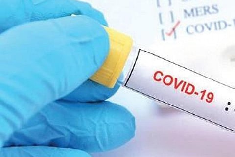 Image for representational purpose only