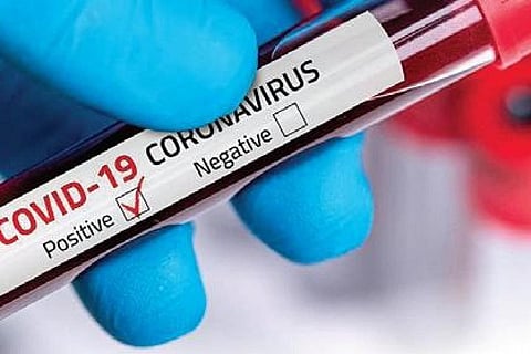 Image used for representation