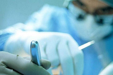 Image for representation