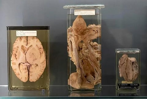 The collection of around 50,000 human body parts at Vienna's Natural History Museum was first conceived in 1796 to help train medical students (Photo | AFP)