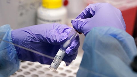 Four more people test positive for Omicron in Telangana; three of them not from 'at-risk' country