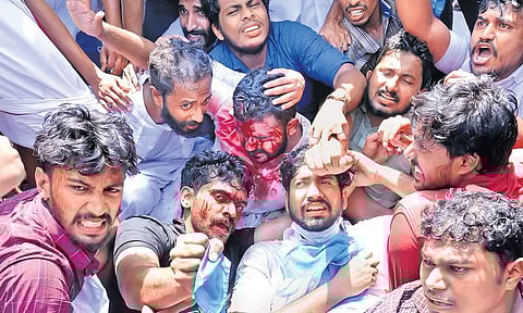 KSU state president K M Abhijith, NSUI national coordinator Nabeel Kallambalam and others, who were injured in the clash with the police in front of the Secretariat, raise slogans on Thursday | Vincen