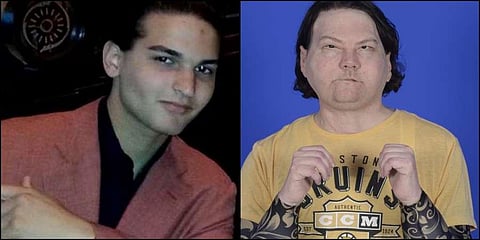 (L) Joe DiMeo before the accident and (R) after the surgery. (Photos | AFP)