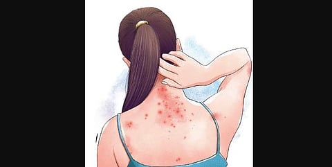 Illustration: Tapas Ranjan