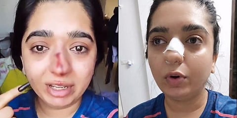 Instagram beauty influencer Hitesha Chandranee who alleged she was assaulted by a Zomato delivery boy (Photo | Instagram screengrabs)