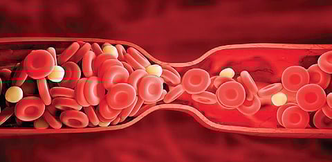 Representational image