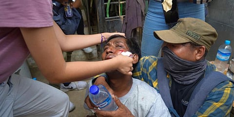 Anti-coup protesters attend to an injured rallyist during a demonstration in Yangon, Myanmar. (Photo | AP)