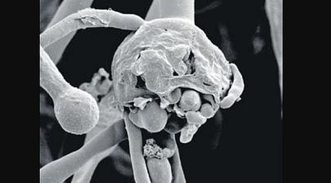 A magnified scan of Black fungus. (Representational Image)