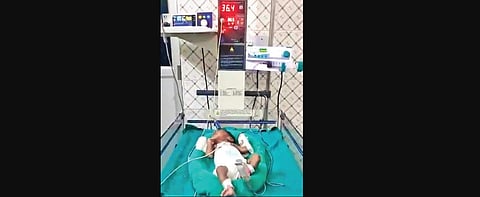 25 day-old premature baby beats COVID-19 in Odisha's Nuapada
