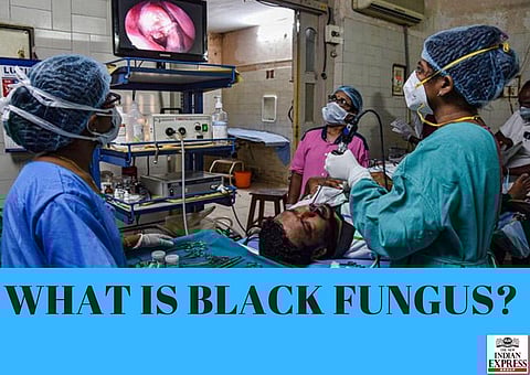 WHAT IS BLACK FUNGUS? Mucormycosis or black fungus is caused by a group of fungal moulds called mucormycetes. These fungi live throughout the environment, particularly in soil and in decaying organic matter, such as leaves, compost piles or rotten wood.
