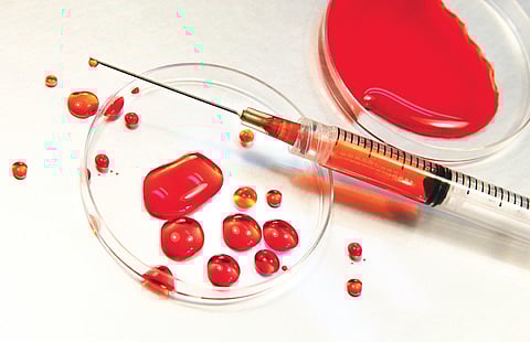 For representational purposes