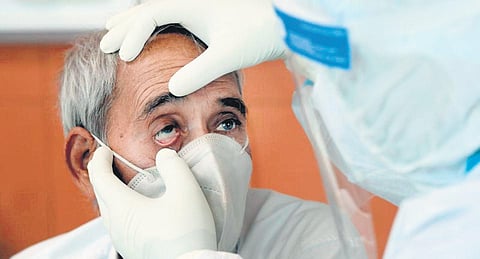 Delhi declares Mucormycosis as an epidemic