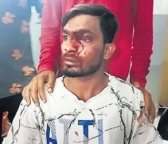 Ashraf’s left eye was injured in the incident.