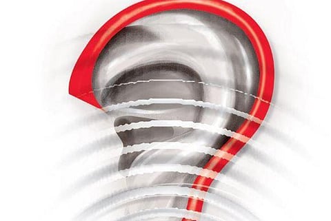 Now, questions over Delta variant link to hearing loss