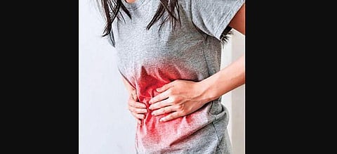 For representational purposes