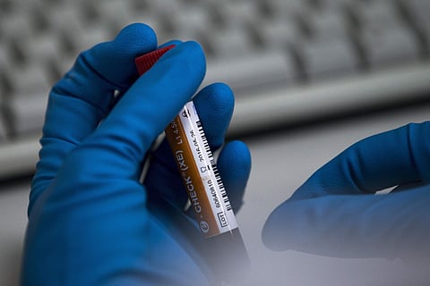 CWG medal winner para sportsperson under dope scanner after morphine found in sample