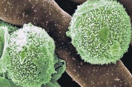 Green fungus, a new worry for Kochi's medical system