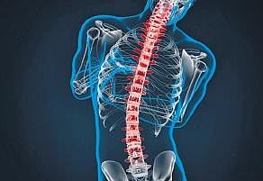Right cure for the curved spine 