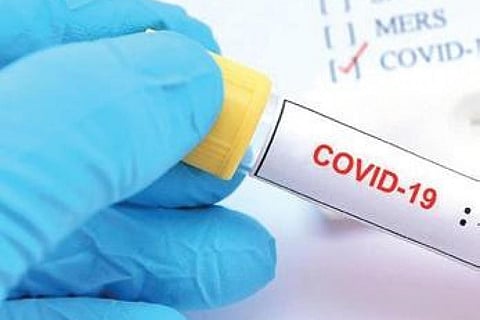 Image for representational purpose only