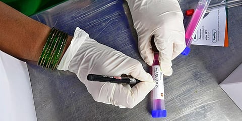 Image for representation. (File photo | Shriram BN)