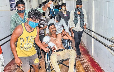 An injured person at Capital Hospital in Bhubaneswar on Monday | Express