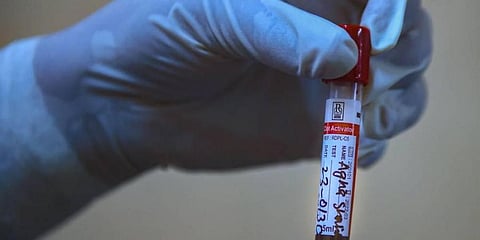 Image for representation (File Photo | PTI)