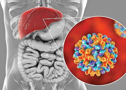 This year, the Blumberg Oration was awarded to Prof Robert Gish, Medical Director of Hepatitis B Foundation, USA (Representational Photo)
