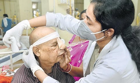 A doctor treats a patient infected with mucormycosis. Image for representation (File Photo| PTI)