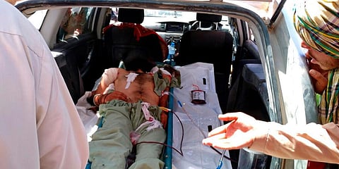 An injured man receives medical treatment after fighting between Taliban and security personnel, inside the city of Farah, capital of Farah province, southwest Afghanistan, Aug. 11, 2021. (Photo | AP)