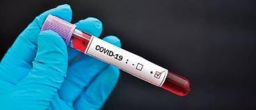 Each Covid patient infected 12 others, shows serosurvey in Karnataka