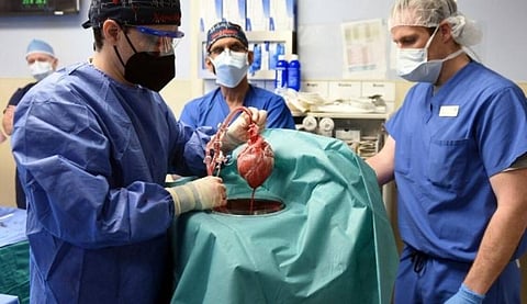 Members of the surgical team show the pig heart for transplant into patient David Bennett in Baltimore on Friday.(Mark Teske/University of Maryland School of Medicine via AP)