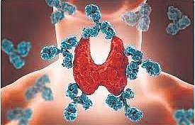 The Curious Case of Autoimmune Disorders  