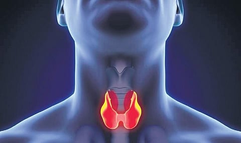 Image for representational purpose only.