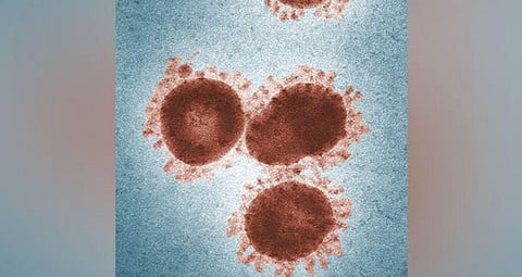 For representational purposes (Photo | ANI)