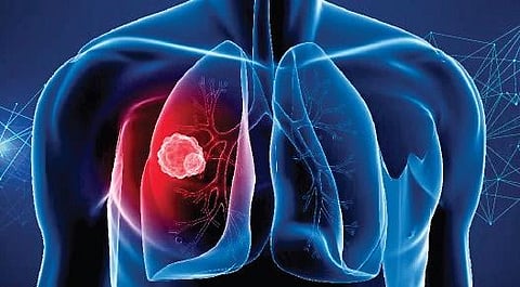 Image for representation purpose only.