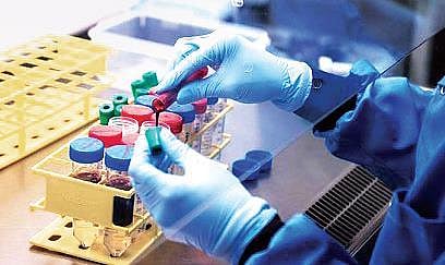 More people rely on private labs for Covid test