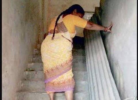 Representational image of a woman with Filariasis. (File photo)