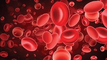 Representational image