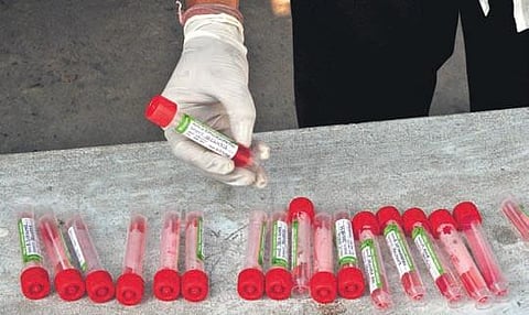 A worker arranges swab samples collected for Covid testing in Vizag. (Photo | EPS/G Satyanarayana)