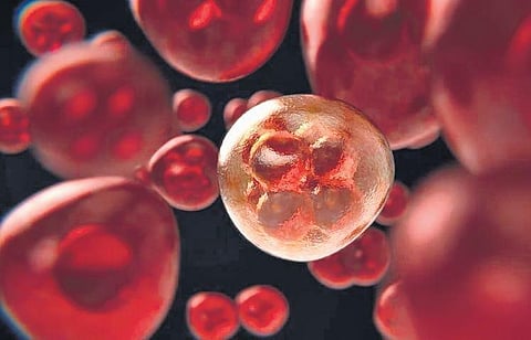 Representational Image