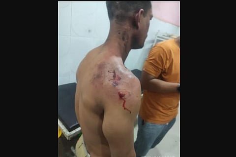 A person who got injured  during the clash with police (Photo | EPS)