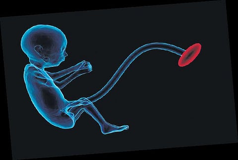 Representational Image